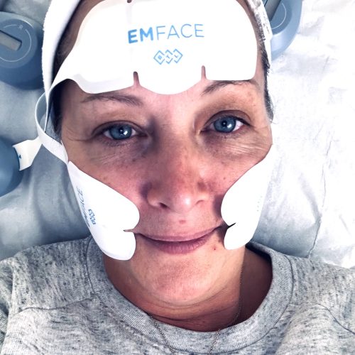 EmFace - the Botox alternative now in Oxfordshire
