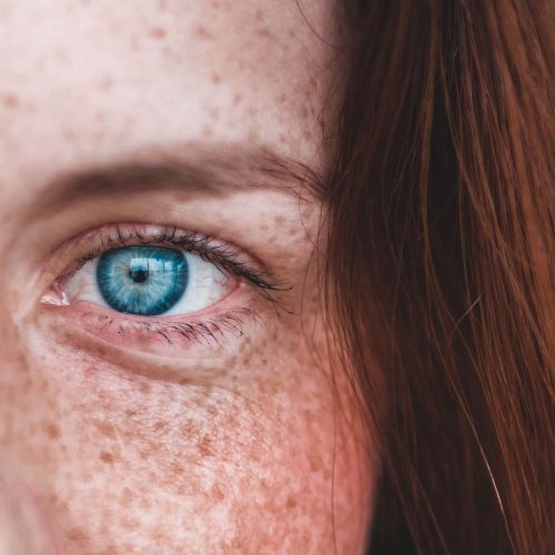 Eye spa! Top tips to banish dry eyes